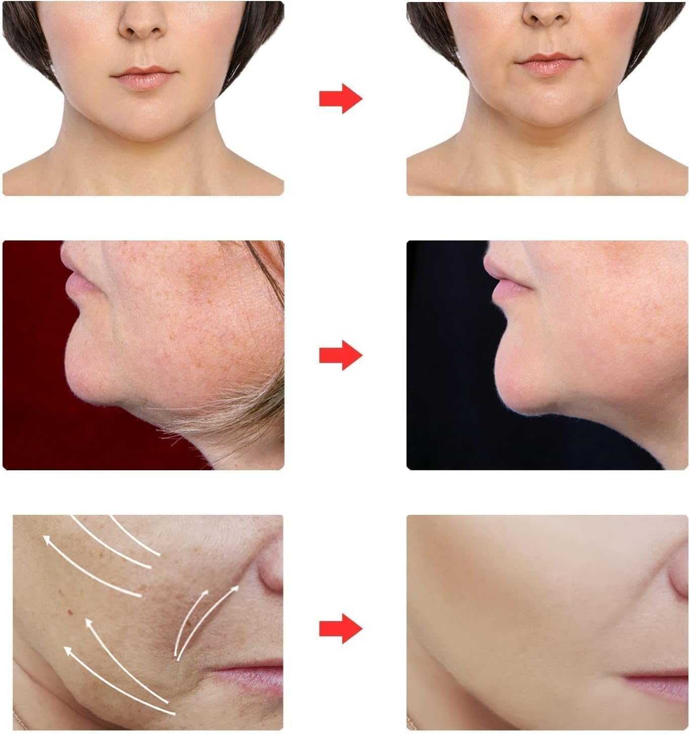 Reusable Facial Belt for V-Shaped Face & Jawline